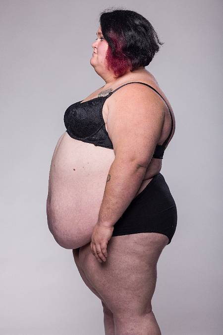 Váha 171 kilo a boj o život: První díl Extrémních proměn vás dostane